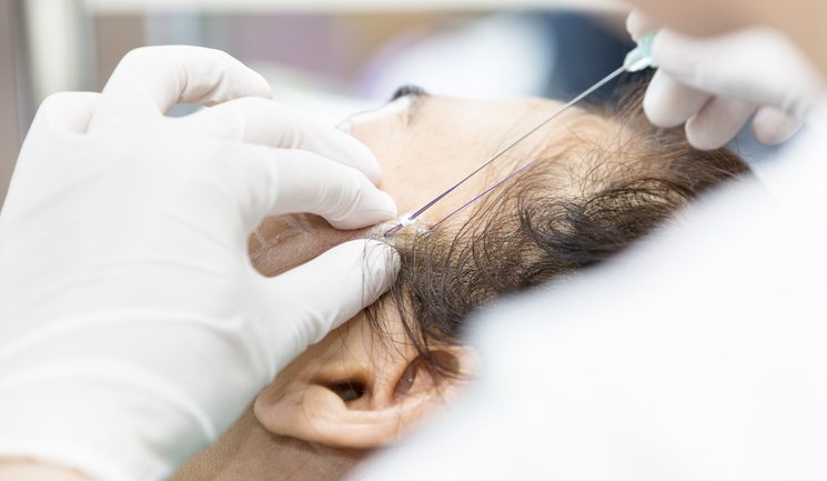 งานความงามบนใบหน้าที่ CUBE Dental Clinic